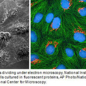 Renart_Intercellular.jpg