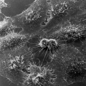 HeLa_Cells_Image_3709-PH.jpg